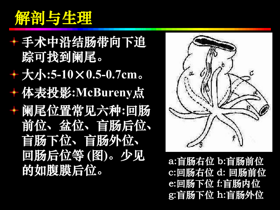 阑尾炎医学知识培训培训课件.ppt_第3页