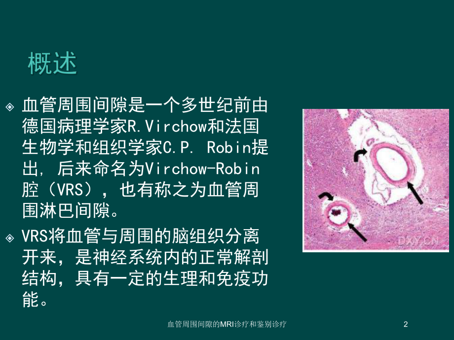 血管周围间隙的MRI诊疗和鉴别诊疗培训课件.ppt_第2页