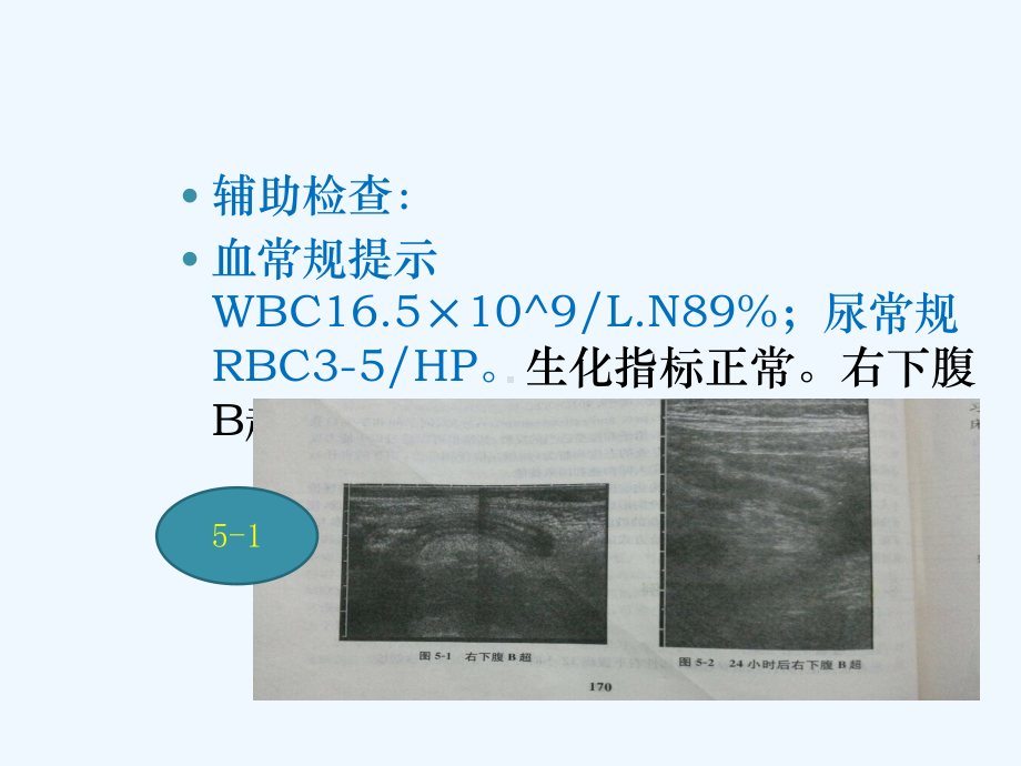 阑尾炎-教学查房-经典教案课件.ppt_第3页