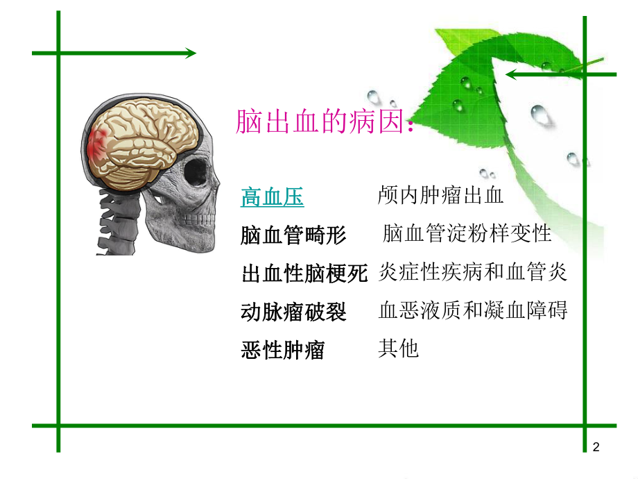 脑出血的MRI表现学习课件.ppt_第2页