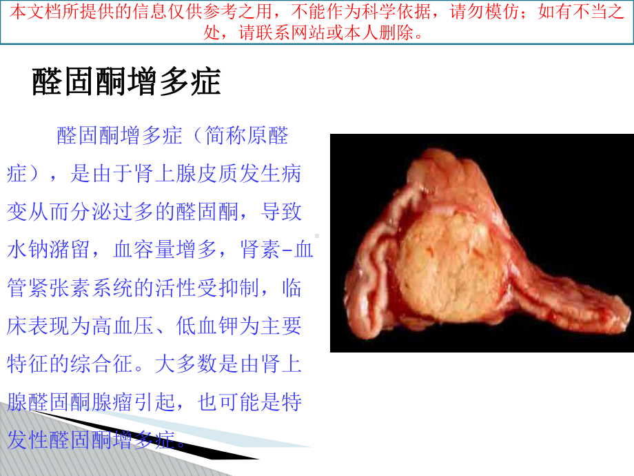 醛固酮增多症培训课件.ppt_第1页