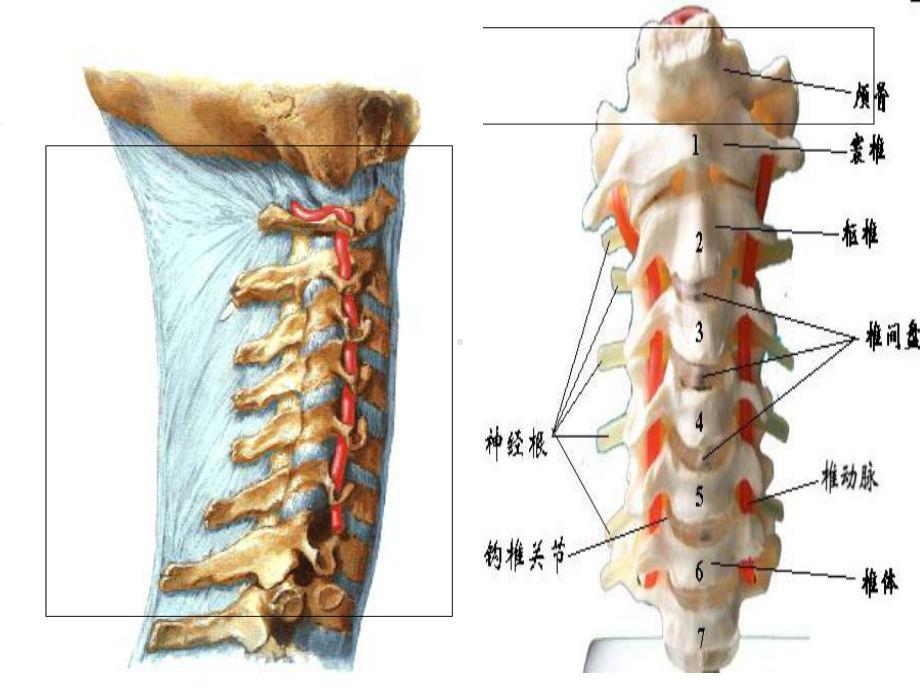 脊髓型颈椎病患者的个案护理查房课件.pptx_第2页