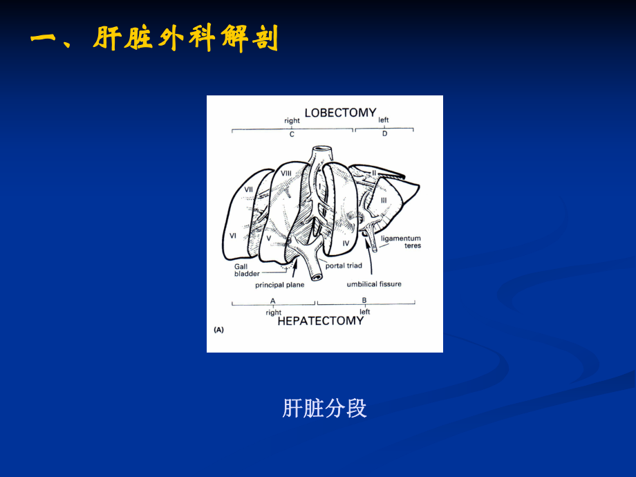 临床肝切除的主要并发症及防治-课件.ppt_第2页