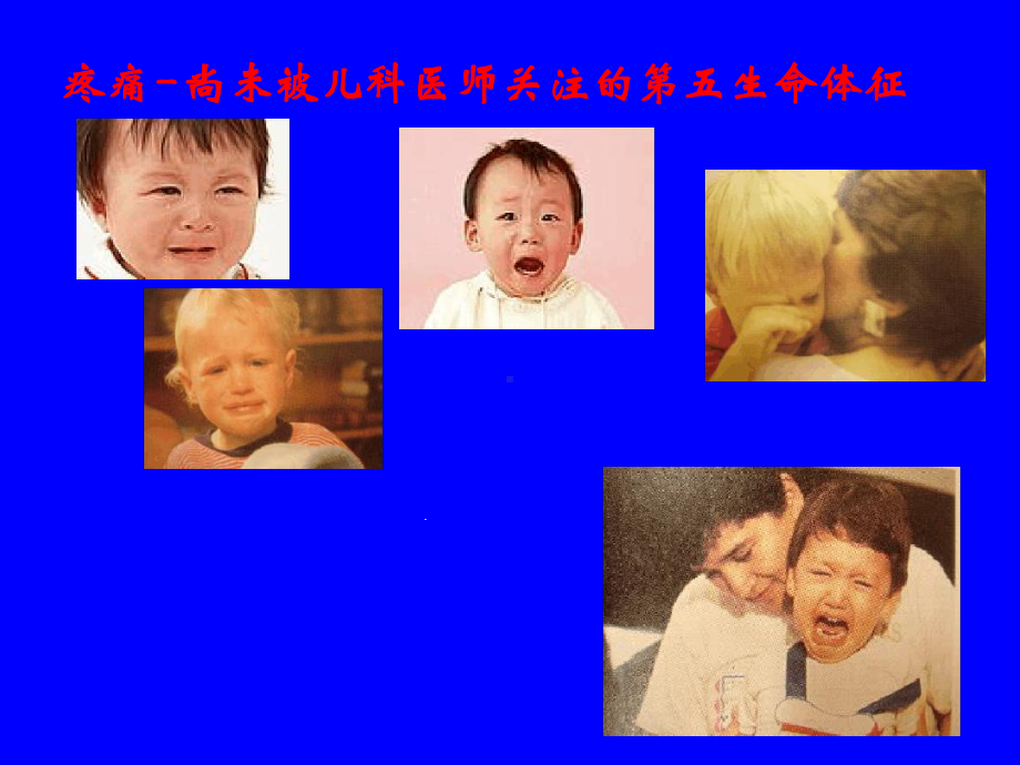 镇静镇痛儿科课件.ppt_第1页