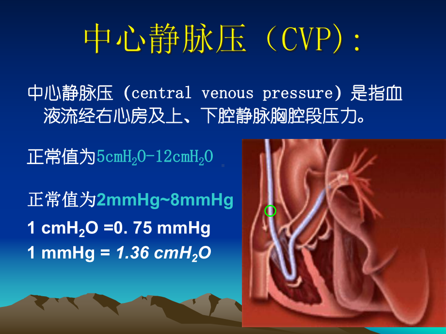 中心静脉压(CVP)监测和波形分析报告课件.ppt_第3页