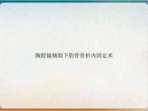 胸腔镜辅助下肋骨骨折内固定术实用版课件.ppt