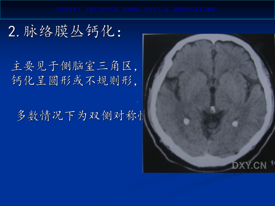 颅内钙化和其相关疾病课件.ppt_第3页