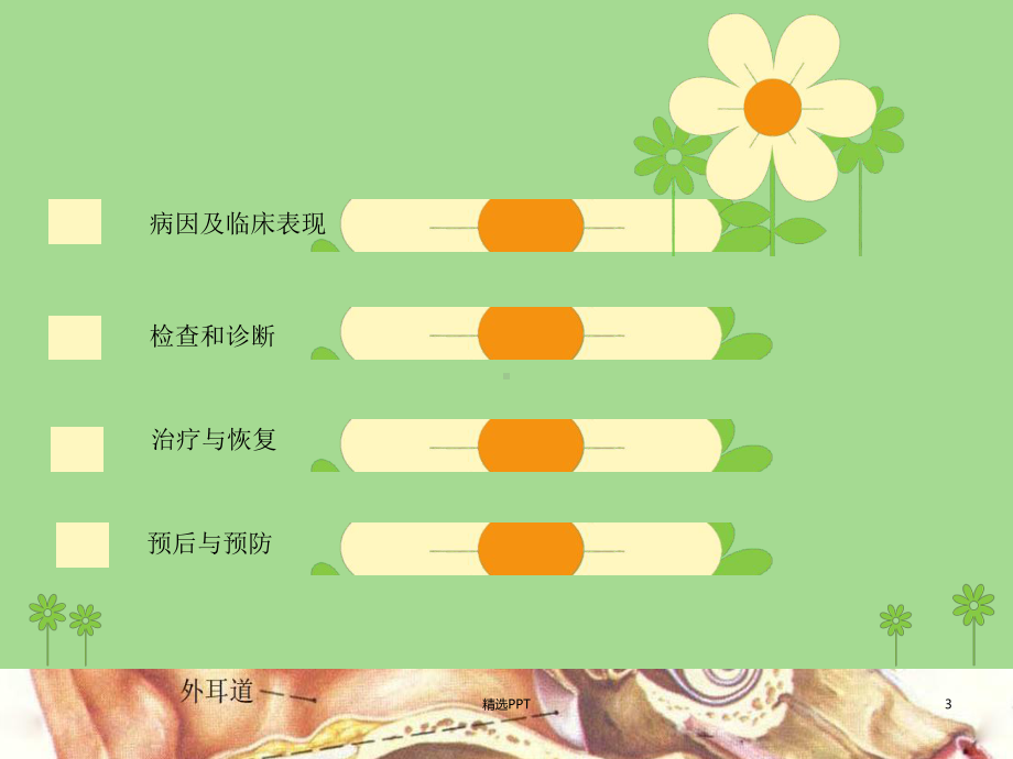 突发性耳聋的护理课件.ppt_第3页