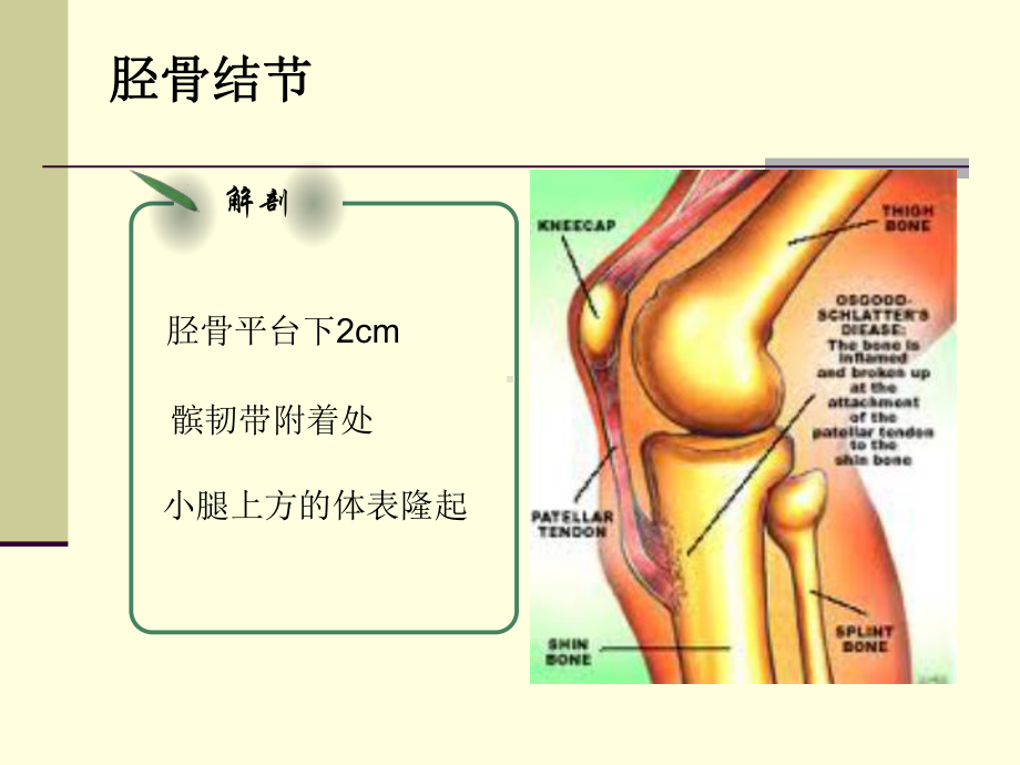 胫骨结节骨软骨炎OSD课件.ppt_第2页