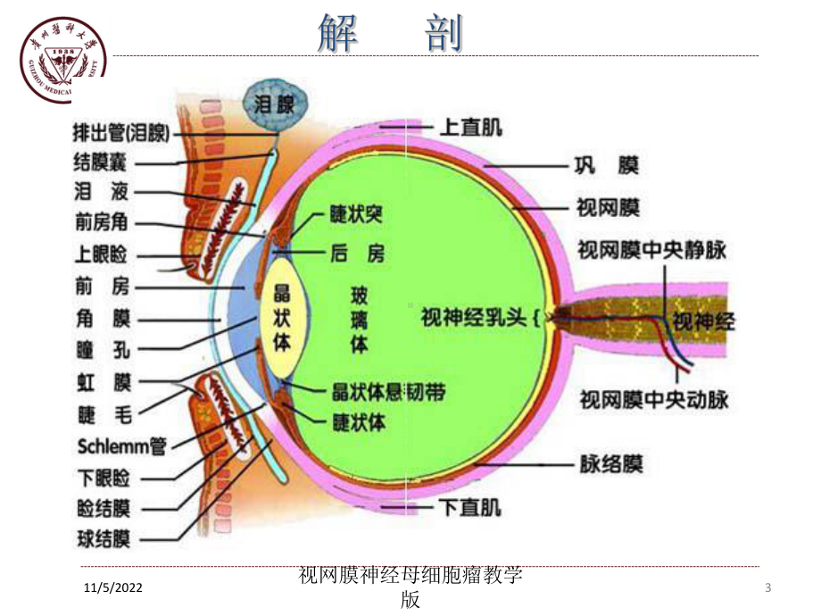 视网膜神经母细胞瘤教学版培训课件.ppt_第2页