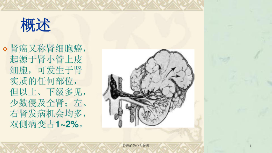 肾癌的治疗与护理课件.ppt_第1页