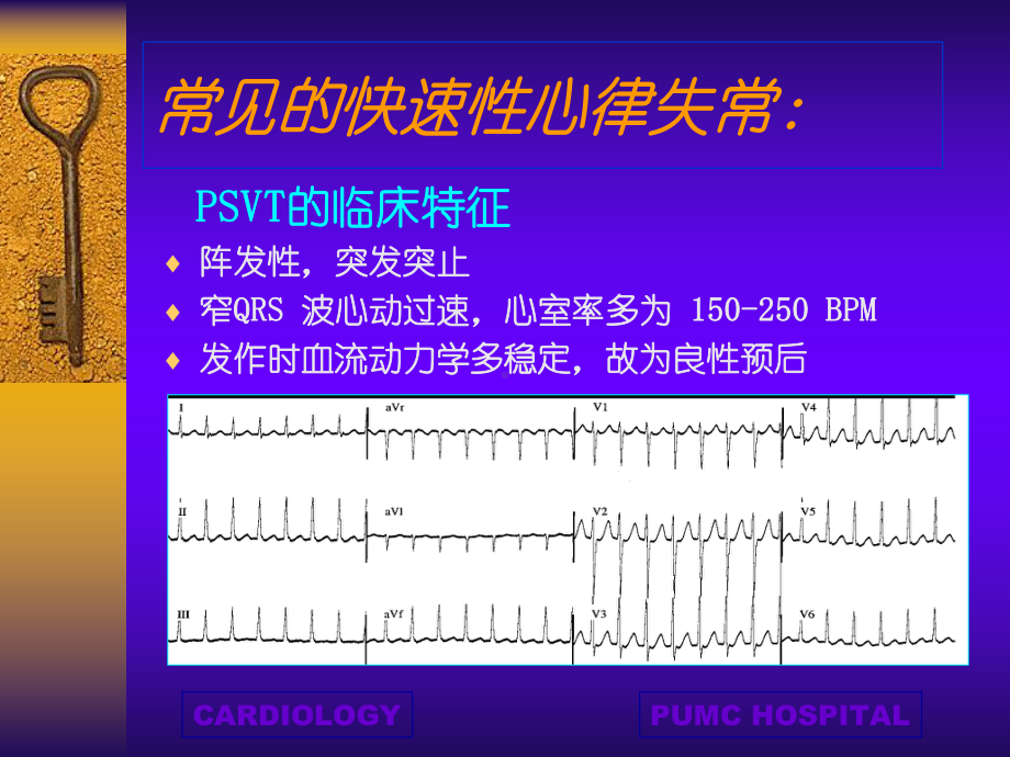 快速性心律失常课件.ppt_第3页