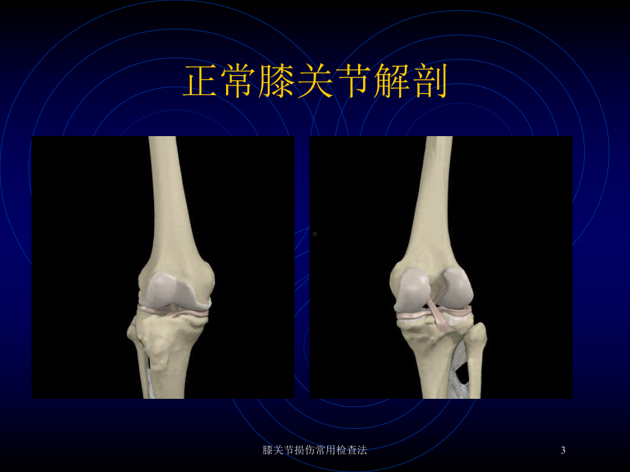 膝关节损伤常用检查法培训课件.ppt_第3页