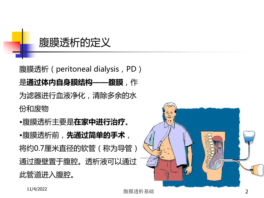 腹膜透析基础培训课件.ppt_第2页