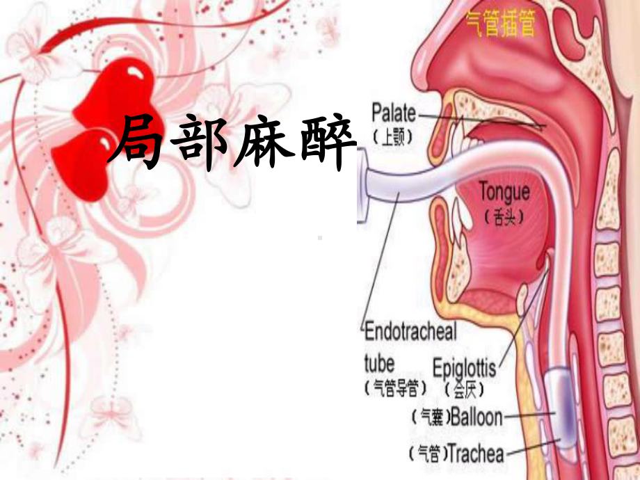 局部麻醉护理课件.ppt_第1页