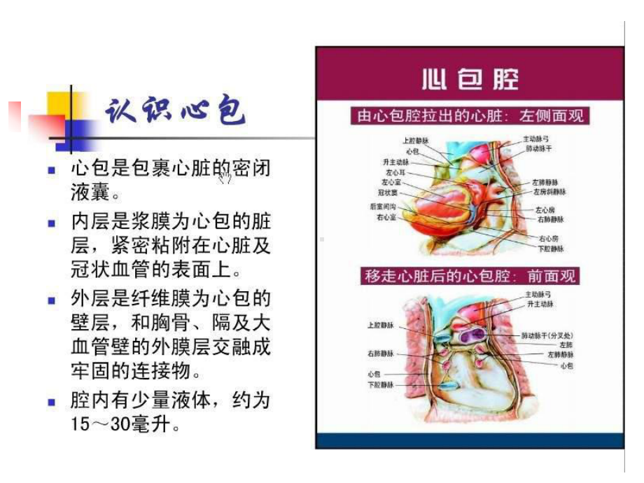 心包压塞时外科干预时机的选择课件.ppt_第2页