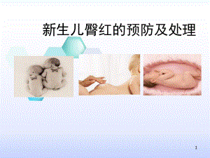 新生儿臀红的预防及护理课件.ppt