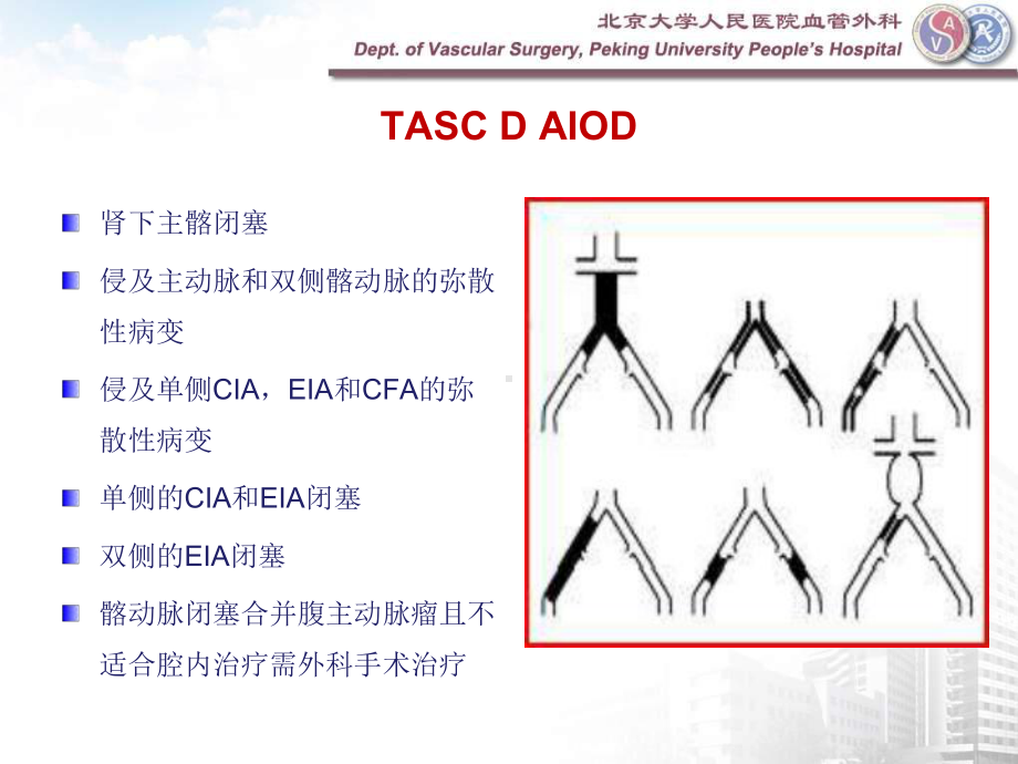 主髂动脉TASC-D级病变的外科治疗策略课件.ppt_第3页