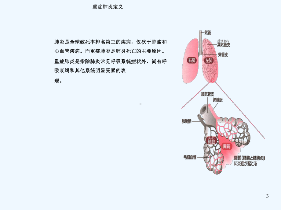 重症肺炎护理个案课件.ppt_第3页