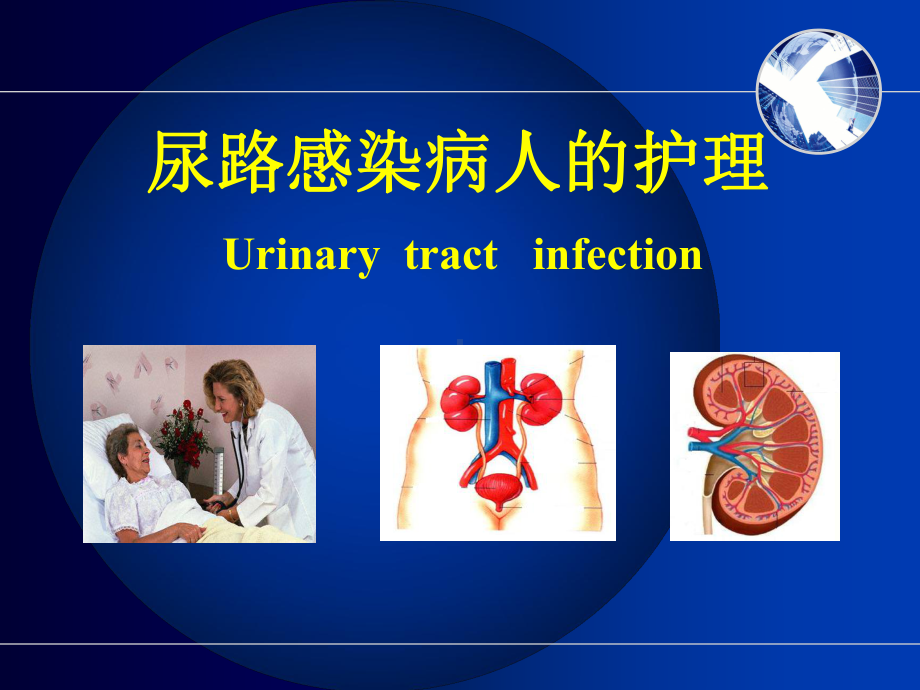 尿路感染护理非常全面研究课件.ppt_第1页