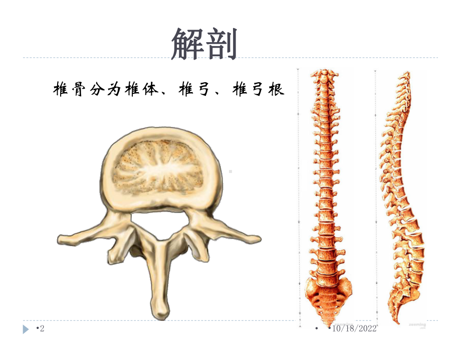 腰椎骨折患者的护理参考课件.ppt_第2页