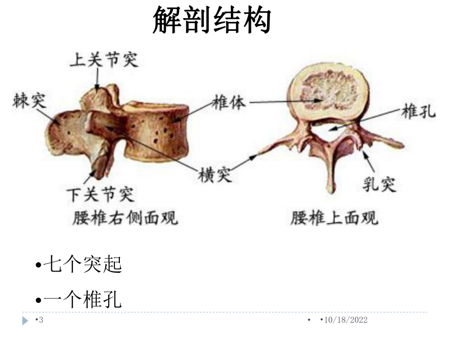 腰椎骨折患者的护理参考课件.ppt_第3页