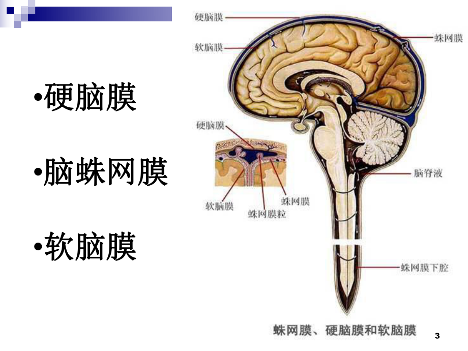 脑膜瘤的护理查房课件.pptx_第3页