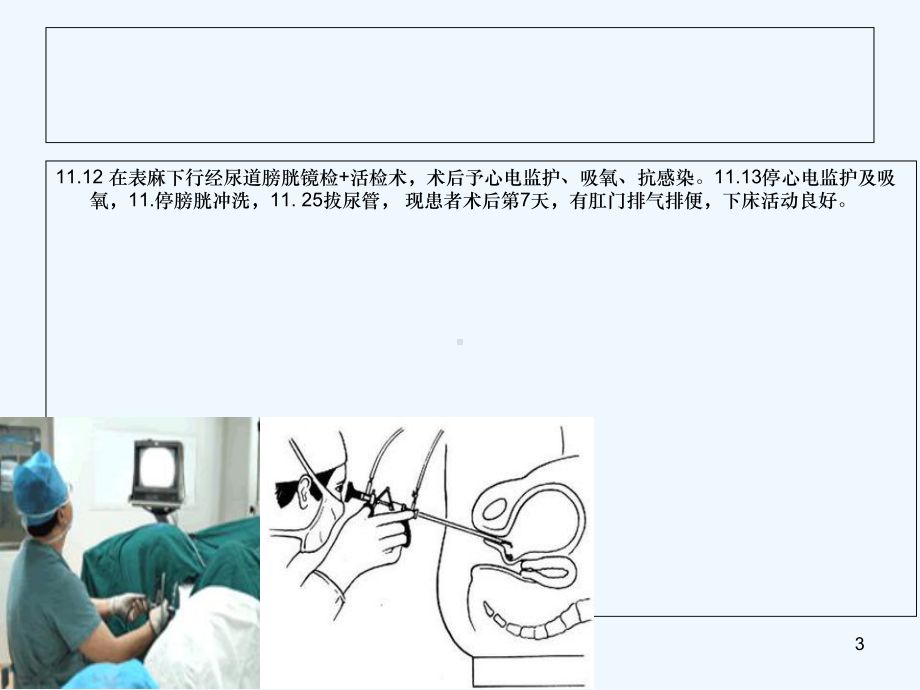 输尿管癌的护理查房课件.ppt_第3页