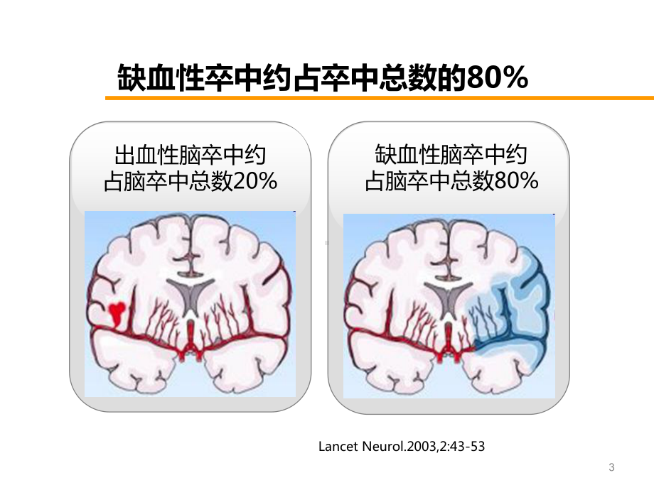 通心络胶囊在缺血性脑卒中治疗中的作用课件-2.ppt_第3页