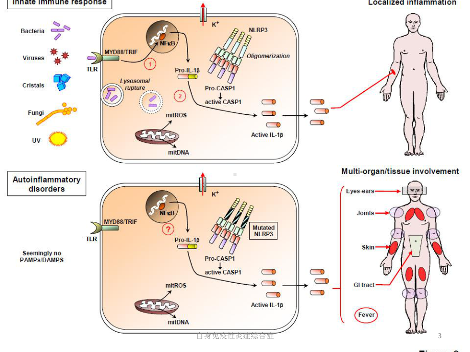 自身免疫性炎症综合症培训课件.ppt_第3页