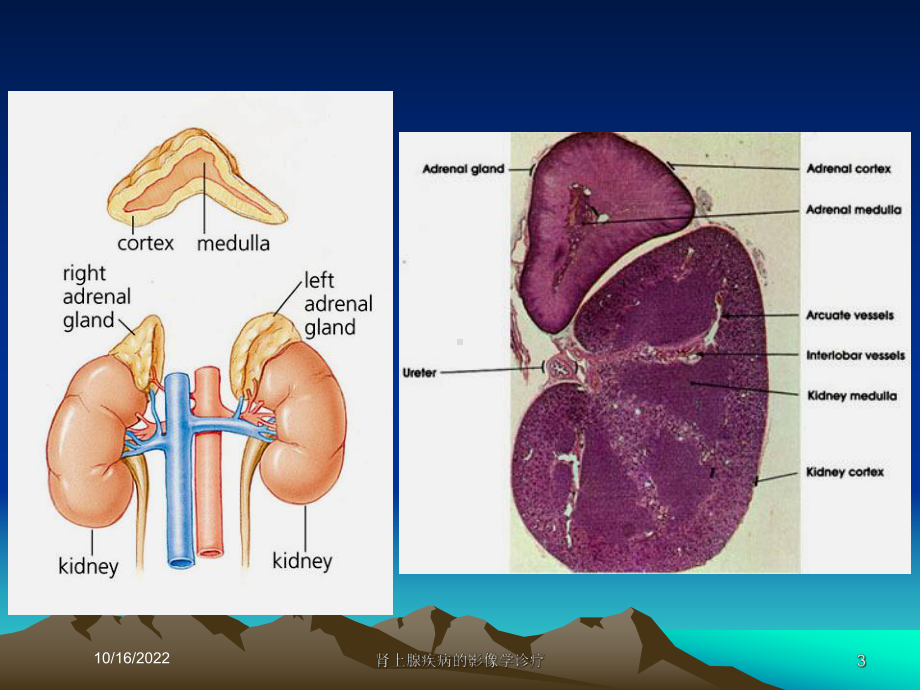 肾上腺疾病的影像学诊疗培训课件.ppt_第3页