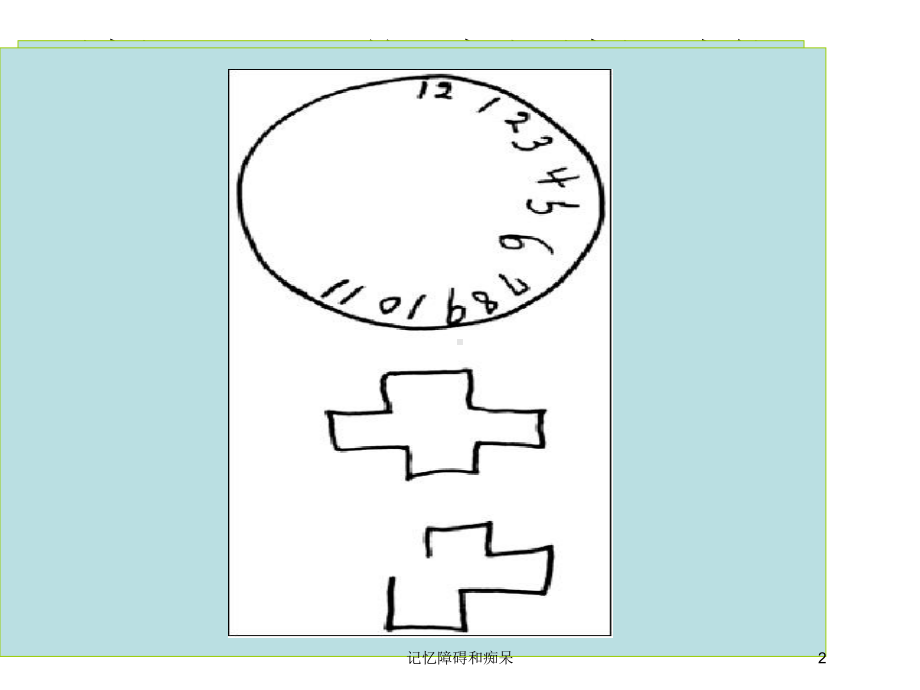 记忆障碍和痴呆培训课件.ppt_第2页