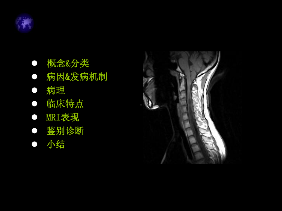 脊髓空洞症mri表现课件.ppt_第2页