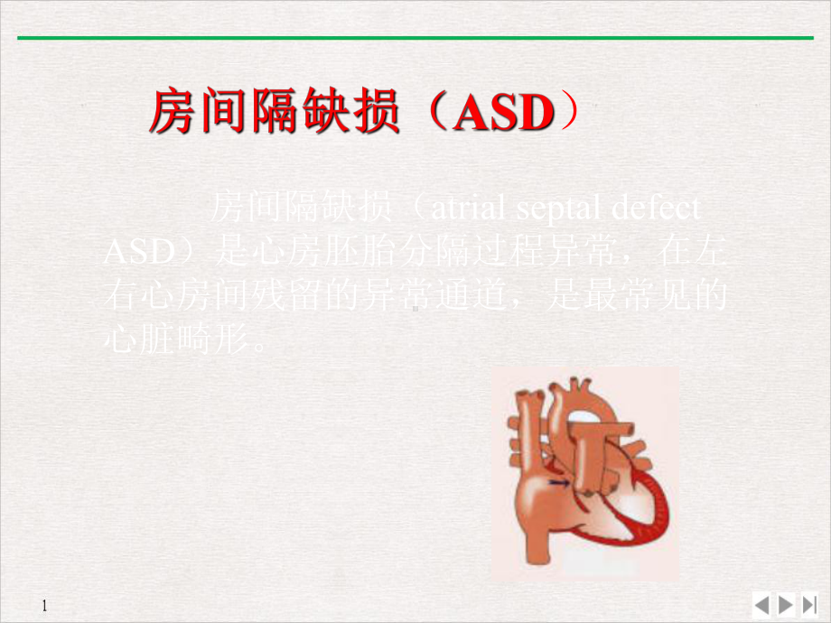 非紫绀型先天性心脏病ASDVSD超声诊断课件.pptx_第3页