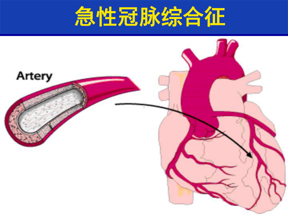 抗凝治疗在ACS中应用-KOL-精选课件.ppt_第2页