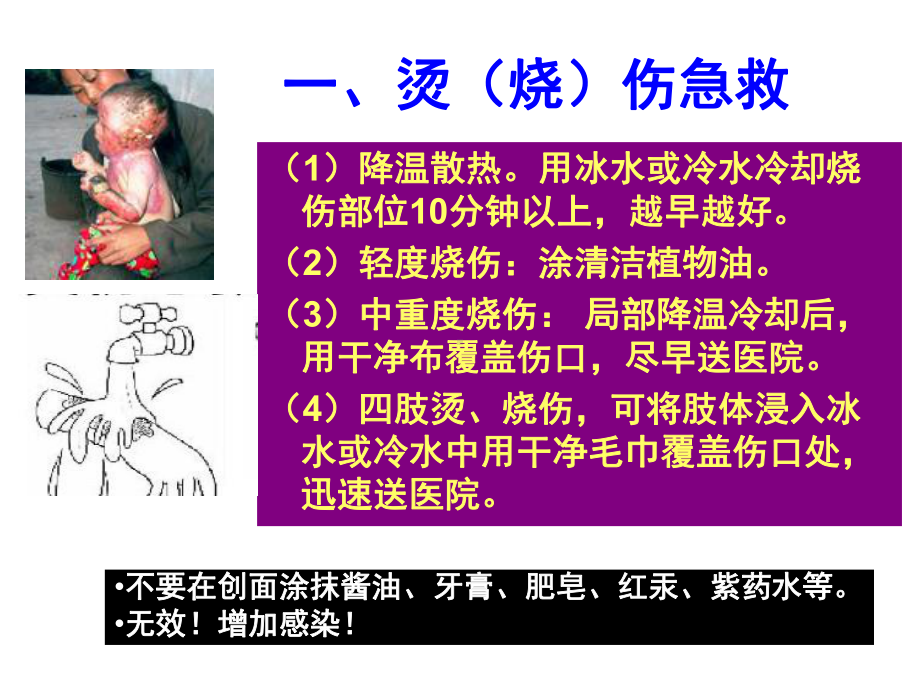 婴幼儿意外伤害预防与急救课件.ppt_第3页