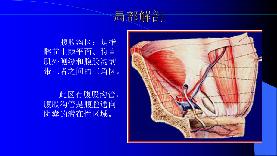 腹腔镜疝修补术医疗护理查房课件.ppt_第1页