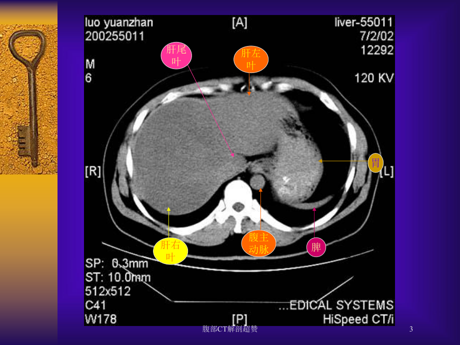腹部CT解剖超赞培训课件.ppt_第3页