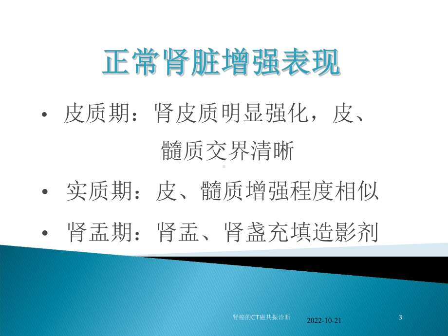 肾癌的CT磁共振诊断培训课件.ppt_第3页