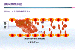 静脉血栓部分版课件.pptx