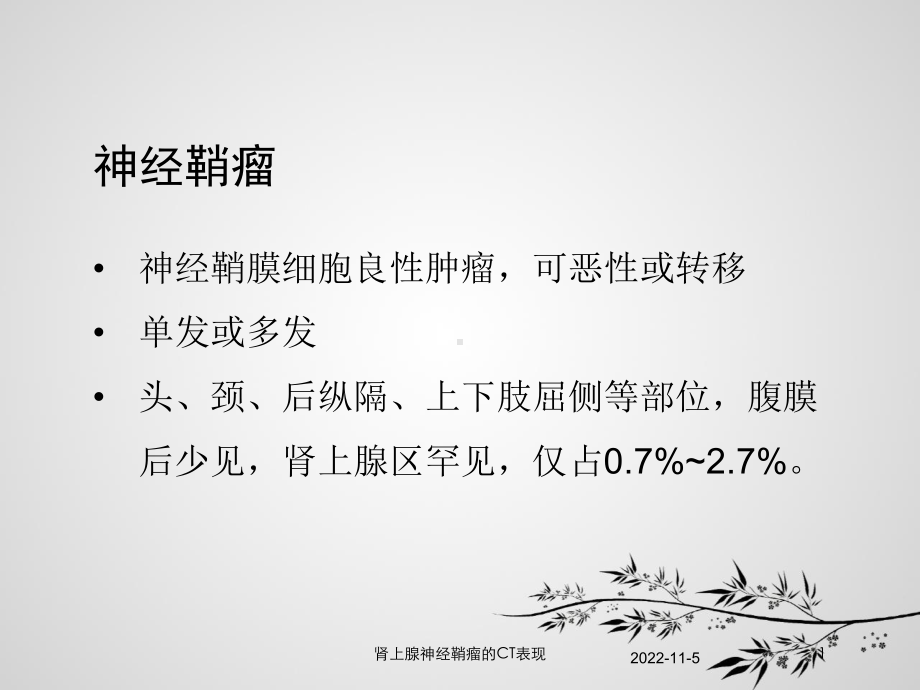 肾上腺神经鞘瘤的CT表现培训课件.ppt_第1页