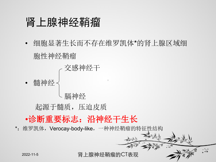 肾上腺神经鞘瘤的CT表现培训课件.ppt_第2页