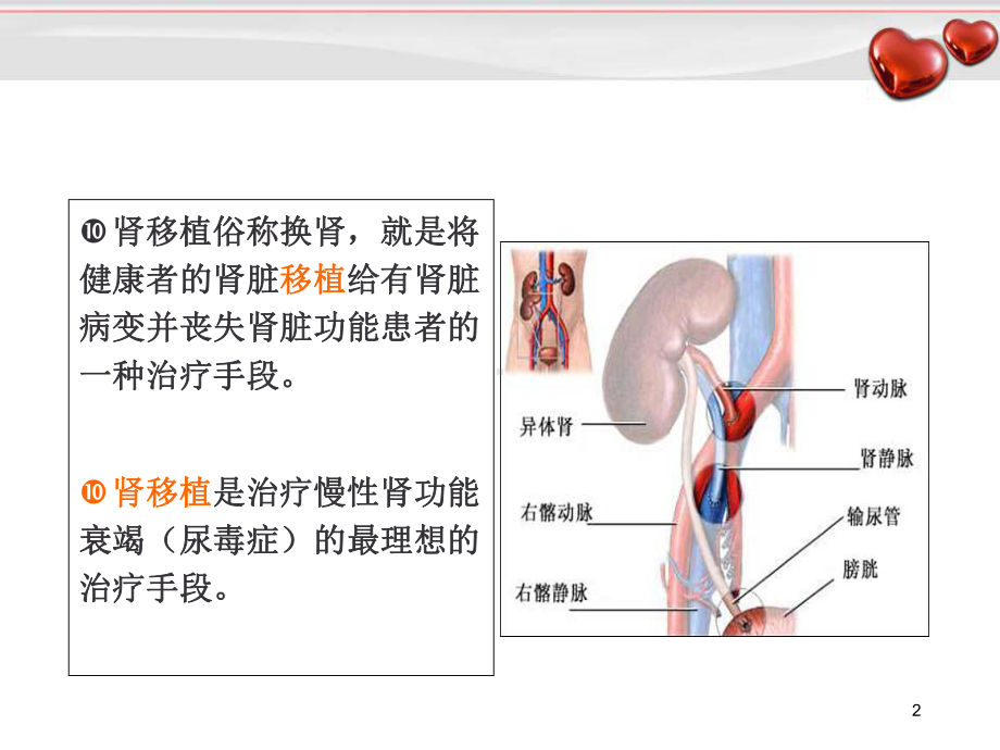 肾移植的饮食指导教学课件.ppt_第2页