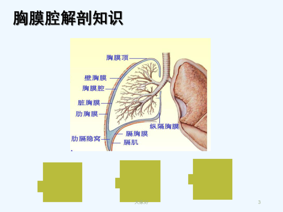 胸腔引流管的护理-课件.ppt_第3页