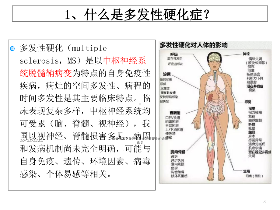 脑脊液寡克隆区带对多发性硬化的诊断意义培训课件.ppt_第3页