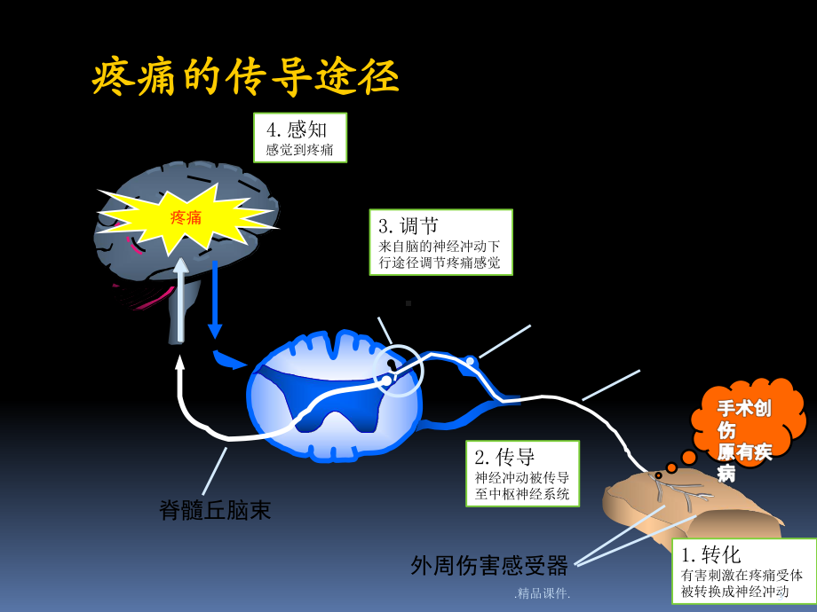 疼痛科科普概述x课件.pptx_第3页