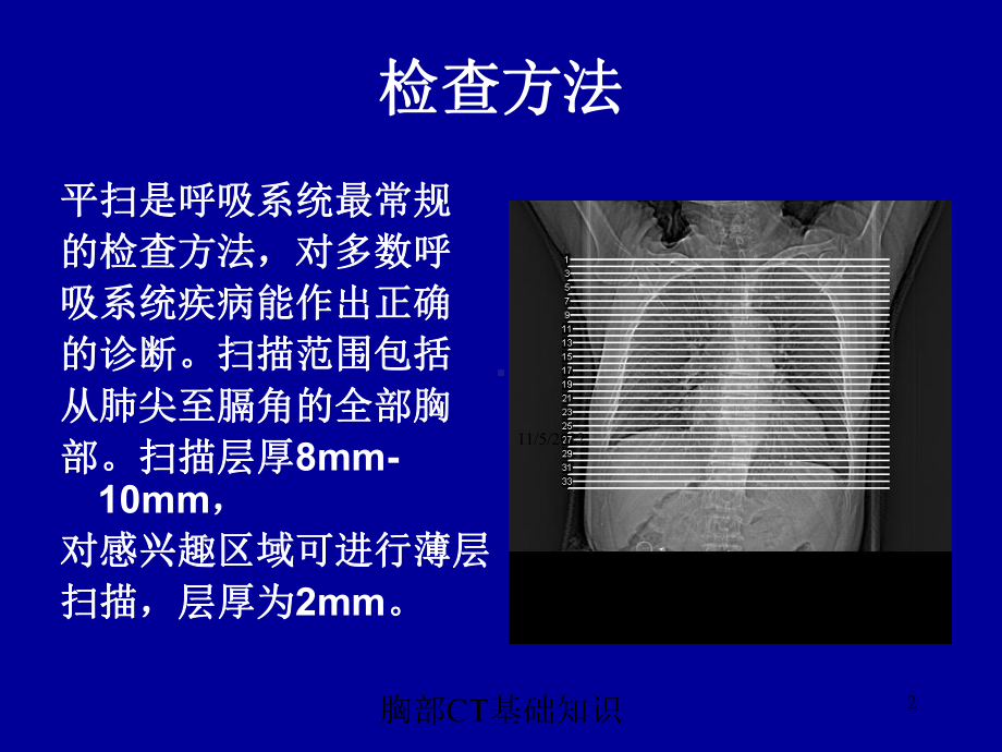 胸部CT基础知识培训课件.ppt_第2页