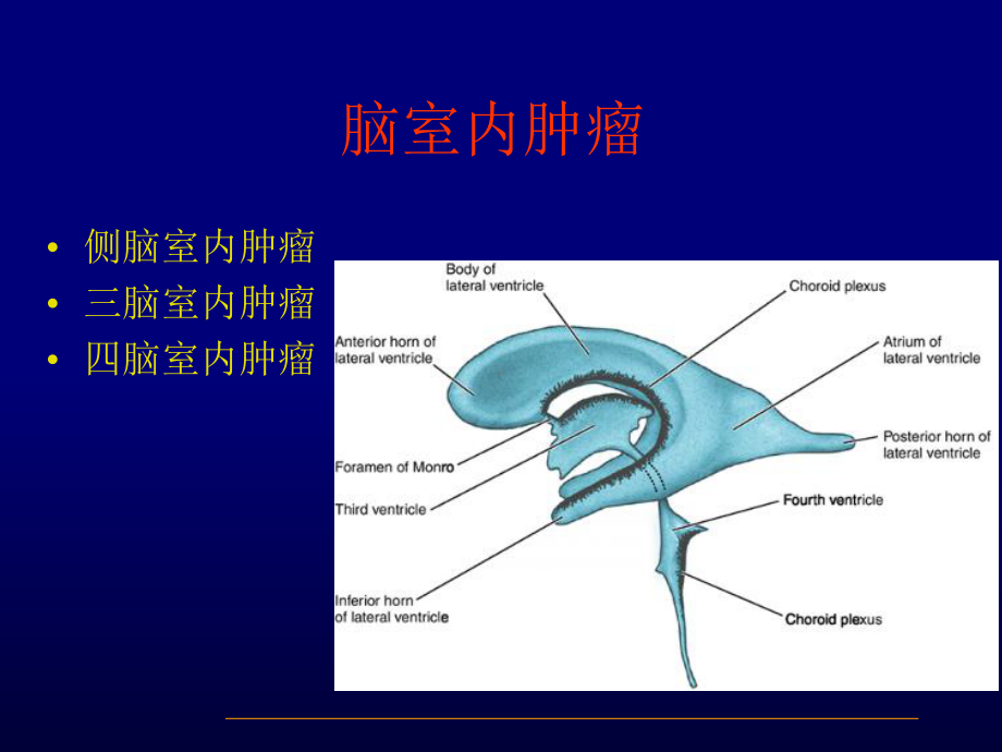 脑室内肿瘤影像诊断课件.ppt_第2页