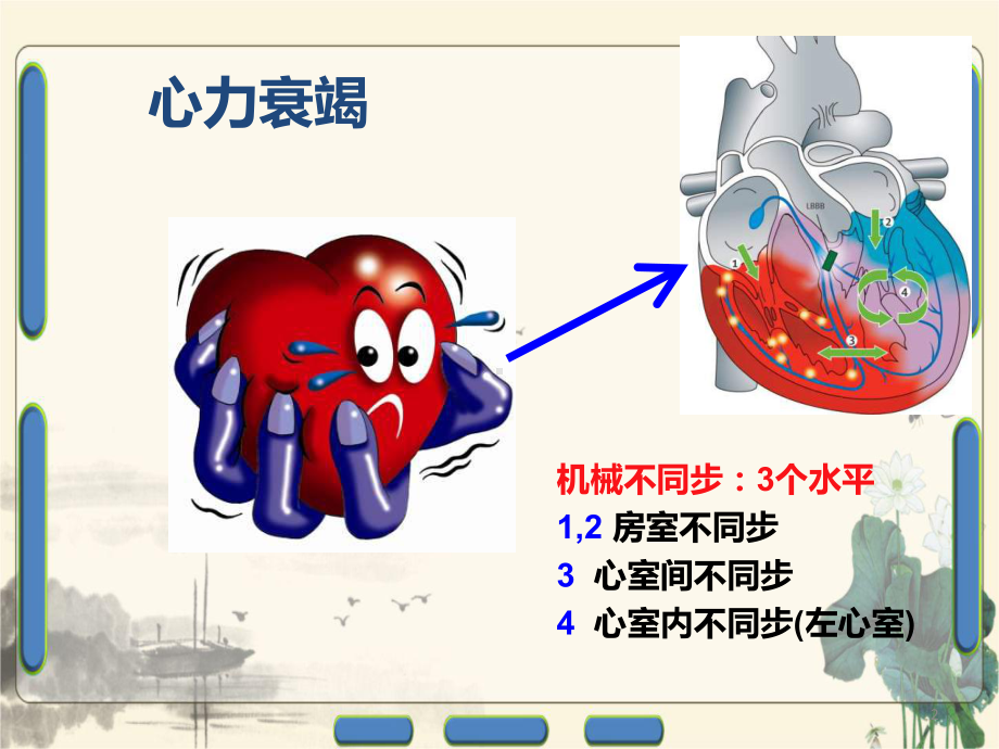 心力衰竭患者CRT治疗适应证和时机课件.ppt_第2页