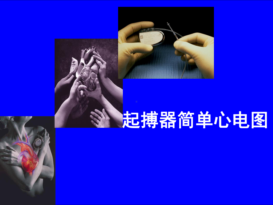 起搏器心电图1课件.ppt_第1页